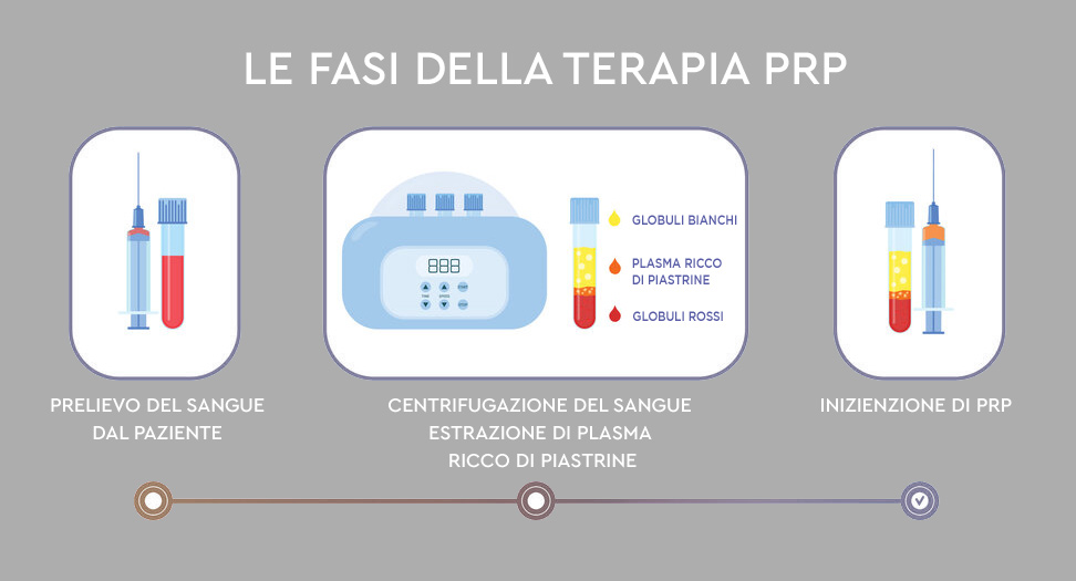 Fasi terapia PRP