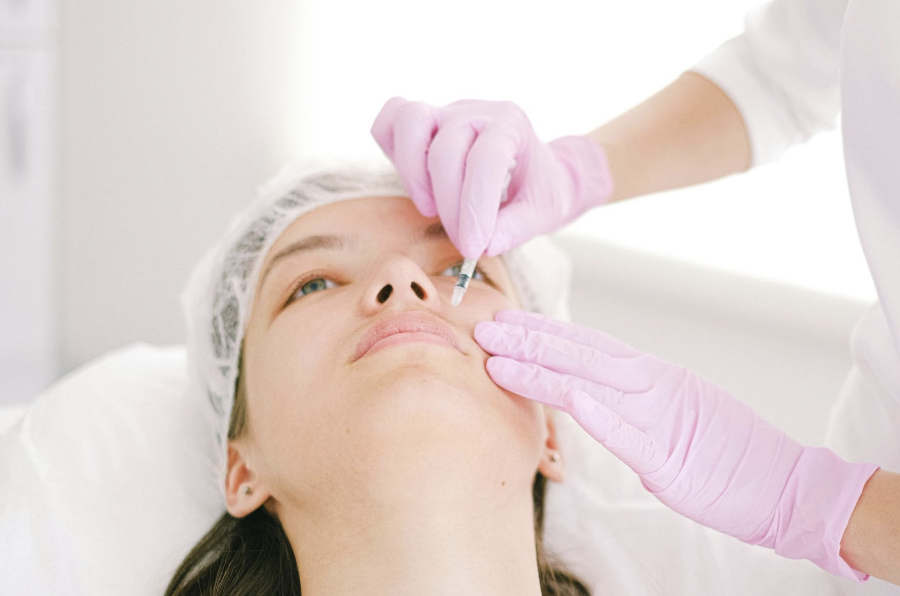 filler rughe naso-labiali - equipe estetica