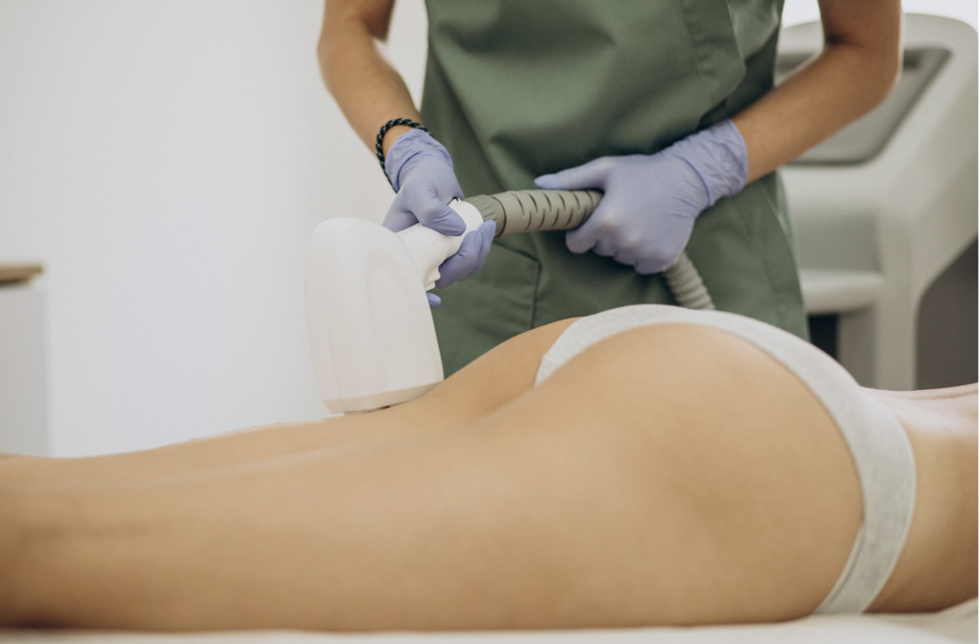 trattamento medico-estetico per migliorare la cellulite su cosce e glutei