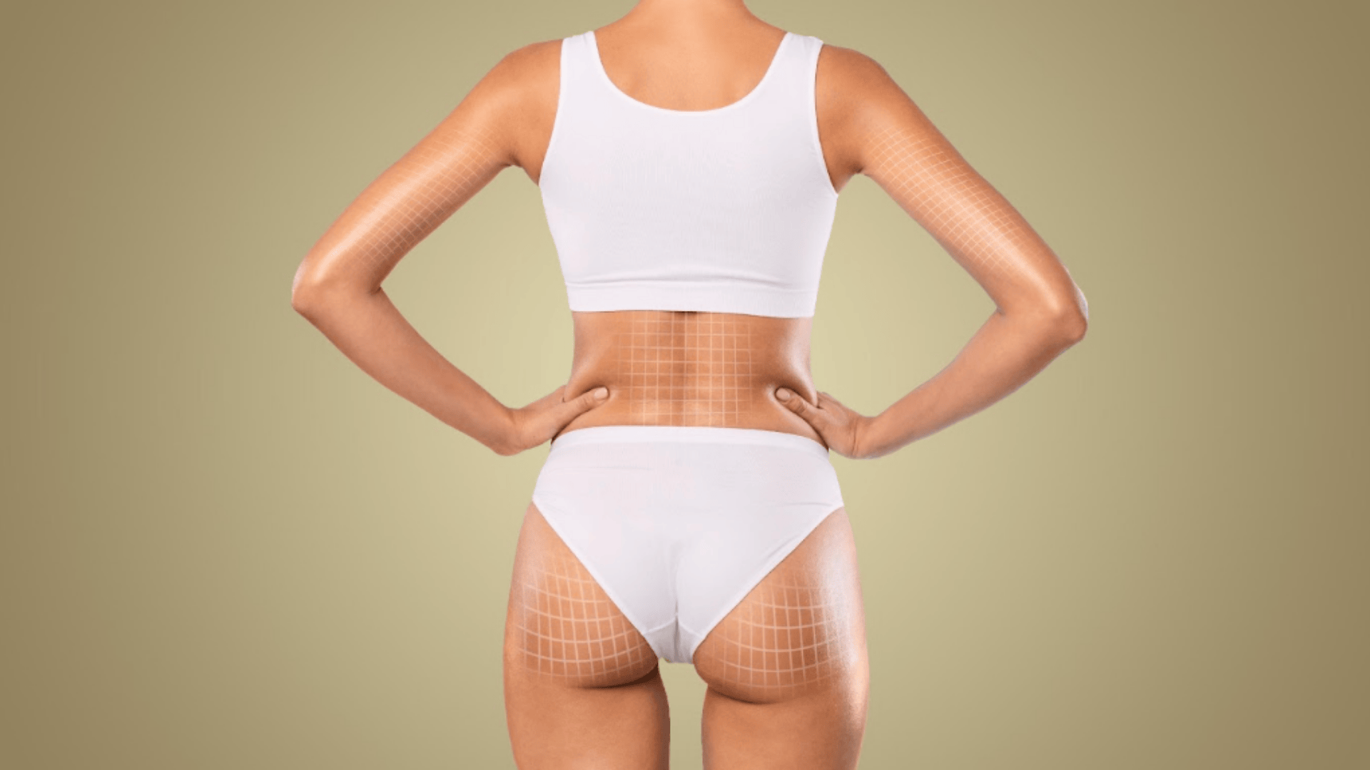  liposuzione laser bergamo - equipe estetica