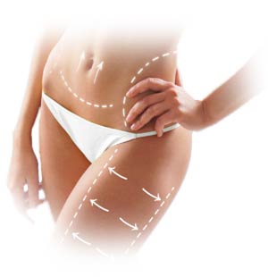 Liposuzione Lipolasersystem