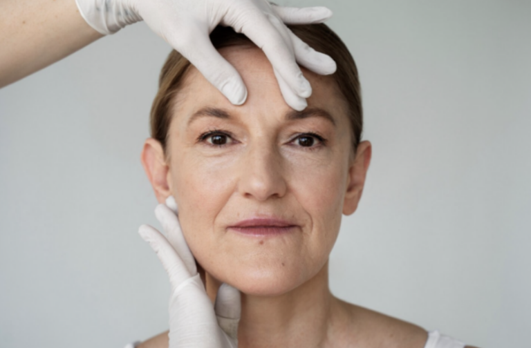 rinfrescare il viso senza bisturi risultato naturale